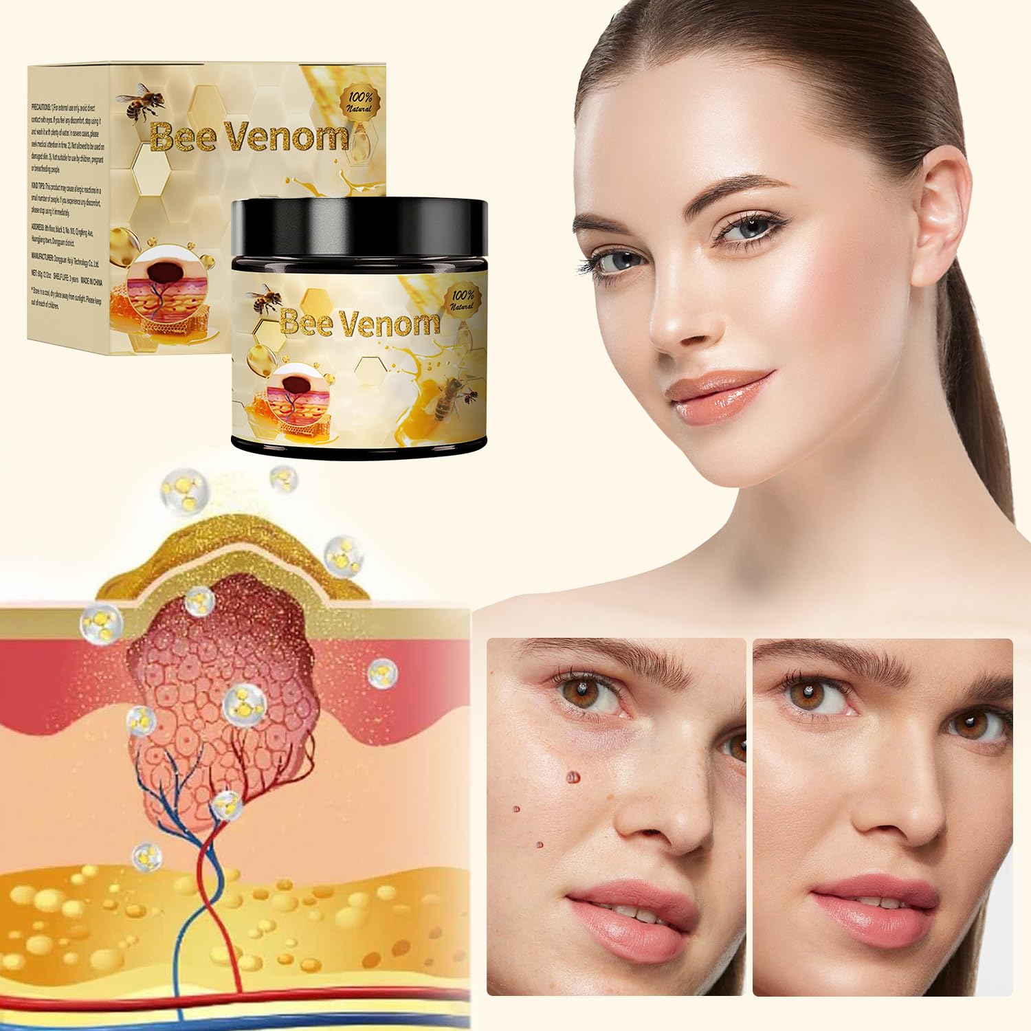 Bee Venom Treatment, New Professional Bee Venom Repair Cream