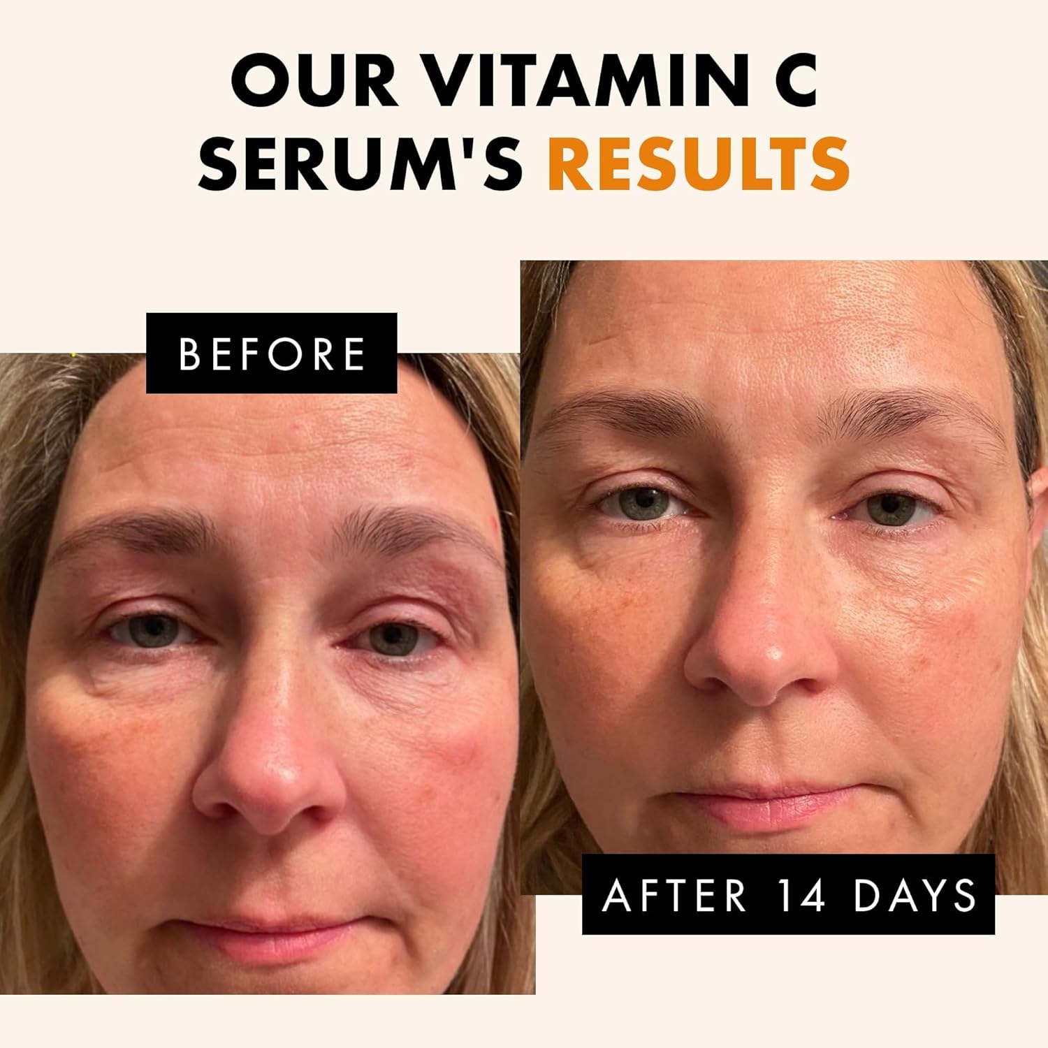 Eclat Skincare Vitamin C Face Serum - Skin Care for Dark Spots, Vitamin C Serum with Hyaluronic Acid